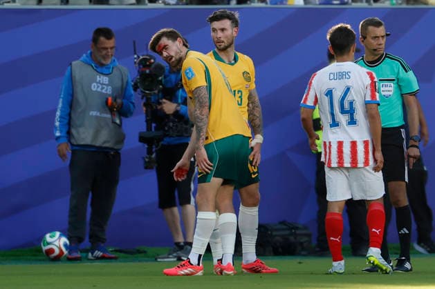 SOCCER PARAGUAY AUSTRALIA WORLD CUP, Bllod pours from a cut on Connor Metcalfe of Australia™s face after a boot to the head during the Group D match between Paraguay and Australia as part of the Men™s FIFA 2026 World Cup at San Francisco Bay Area Stadium in California, USA, Friday, June 26, 2026. ( NO ARCHIVING, EDITORIAL USE ONLY SAN FRANCISCO CALIFORNIA UNITED STATES  Copyright: xJASONxHENRYx 20260626183183723271