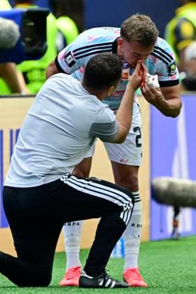 Spain vs Belgium - FIFA World Cup, WM, Weltmeisterschaft, Fussball 2026 LOS ANGELES, UNITED STATES OF AMERICA - JULY 10 : Injury of Castagne Timothy defender of Belgium pictured during the FIFA World Cup 2026 round of 8 match between Spain and Belgium at the SoFi stadium on July 10, 2026 in Los Angeles, United States of America, 10 07 2026 Los Angeles United States of America  Copyright: xJanxDexMeuleneirx