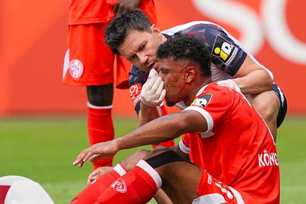 17.07.2026, xydrx, Fußball, Testspiel, 1. FSV Mainz 05 - 1. FC Kaiserslautern, Saison 2026 2027, Stadion am Bruchweg: Ransford Koenigsdoerffer (1.FSV Mainz 05, 11) wird mit Blut überströmt auf dem Platz behandelt DFB regulations prohibit any use of photographs as image sequences and or quasi-video. *** July 17, 2026, xydrx, Soccer, Friendly Match, 1 FSV Mainz 05 vs. 1 FC Kaiserslautern, 2026–2027 Season, Stadion am Bruchweg, Ransford Koenigsdoerffer, 1 FSV Mainz 05, No. 11 is treated on the field after being covered in blood. DFB regulations prohibit any use of photographs as image sequences and or quasi-video. Copyright: HMBxMedia YannisxDreimann