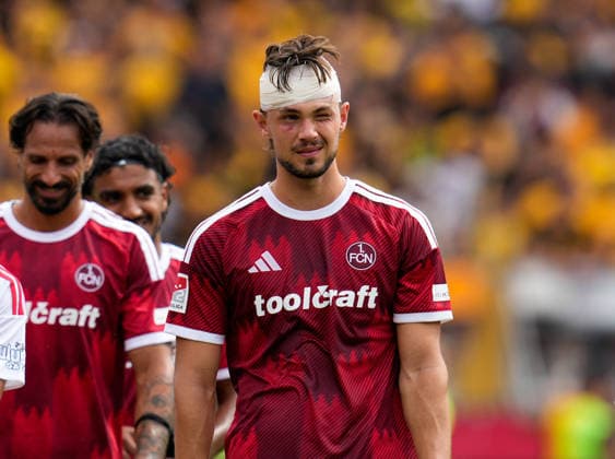 Fynn Otto ( 20) traegt nach einer Verletzung einen Kopfverband. Unter seinem rechten Auge ist ein Bluterguss sichtbar. GER, 1. FC Nürnberg vs SG Dynamo Dresden, 2. Bundesliga, 1. Spieltag, Saison 2026-27, Max-Morlock-Stadion, Nürnberg, 09.08.2026 DFL REGULATIONS PROHIBIT ANY USE OF PHOTOGRAPHS AS IMAGE SEQUENCES AND OR QUASI-VIDEO Foto: HMB Media Scott W. Coleman Nürnberg Max-Morlock-Stadion Bayern GER Copyright: xScottxW.xColemanx