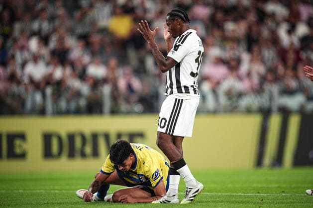 Juventus s Jonathan David reacts after missing a scoring chance during the Serie A soccer match between Juventus and Parma at the Allianz Stadium in Turin, north west Italy - Saturday, August 29, 2026. - Soccer .  Copyright: xMarcoxAlpozzi LaPressex