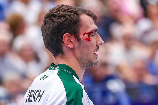 2026.09.03, xkwix, Handball, Handball-Bundesliga, TBV Lemgo Lippe - HSG Wetzlar, PHOENIX CONTACT arena, 2.Spieltag, Saison 2026 2027: Jona Schoch (HSG Wetzlar 22) mit Blut am Kopf wird ausgewechselt Photo: xKamilxWilkowskixPressefotoKochx Nordrhein-Westfalen Deutschland *** September 3, 2026, xkwix, Handball, Handball Bundesliga, TBV Lemgo Lippe vs. HSG Wetzlar, PHOENIX CONTACT arena, Matchday 2, 2026–2027 season: Jona Schoch of HSG Wetzlar, No. 22, is substituted after sustaining a head injury. Photo by xKamilxWilkowskixPressefotoKochx, North Rhine-Westphalia, Germany