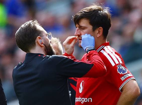 Harry Maguire of Manchester United, ManU receives treatment for an injury Everton v Manchester United, Premier League, Football, Football, Hill Dickinson Stadium, Liverpool, UK - 06 Sep 2026Liverpool Hill Dickinson Stadium United Kingdom EDITORIAL USE ONLY No use with unauthorised audio, video, data, fixture lists, club league logos or live services. Online in-match use limited to 120 images, no video emulation. No use in betting, games or single club league player publications. Copyright: xMattxWest Shutterstockx 17135038r