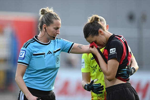 Selina OSTERMEIER LEV injury, injured, pain, with referee Anna Lena HEIDENREICH, Bayer 04 Leverkusen vs. FC Bayern Munich 2–3, soccer, Google Pixel, Women s Bundesliga, 2026–2027 season, Matchday 4, on September 14, 2026, at the Ulrich Habeland Stadium in Leverkusen, Â