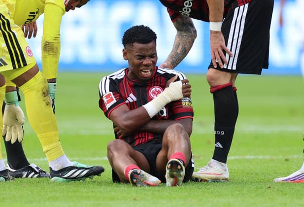 September 19, 2026, Bundesliga Soccer, Eintracht Frankfurt vs. SC Freiburg, from left, Raphael Onyedika of Eintracht Frankfurt holds his shoulder with a pained expression. DFL and DFB regulations prohibit any use of photographs as image sequences and or quasi-video. xdcx Copyright: HMBxMedia Claus