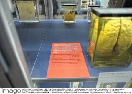 Im Medizinhistorischen Museum der Charite in Berlin wird eine Ausstellung gezeigt, die sich mit dem Verständnis von Seele und Körper in der Antike befasst. Dabei sind einzelne Aufsteller mit Texten und Graphiken sowie Texttafeln und kleinere Exponate in die bestehende Dauerausstellung mit ihren Exponaten, die hauptsächlich aus Präparaten menschlicher Organe und Knochen besteht, eingebunden. Ausstellung Die Seele ist ein Oktopus - antike Vorstellungen vom belebten Körper