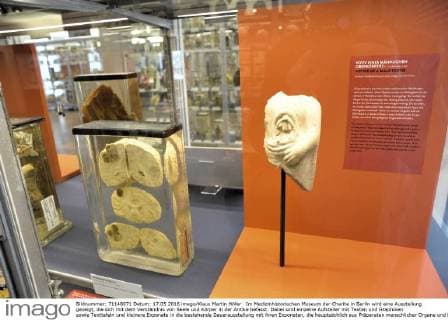 Im Medizinhistorischen Museum der Charite in Berlin wird eine Ausstellung gezeigt, die sich mit dem Verständnis von Seele und Körper in der Antike befasst. Dabei sind einzelne Aufsteller mit Texten und Graphiken sowie Texttafeln und kleinere Exponate in die bestehende Dauerausstellung mit ihren Exponaten, die hauptsächlich aus Präparaten menschlicher Organe und Knochen besteht, eingebunden. Ausstellung Die Seele ist ein Oktopus - antike Vorstellungen vom belebten Körper