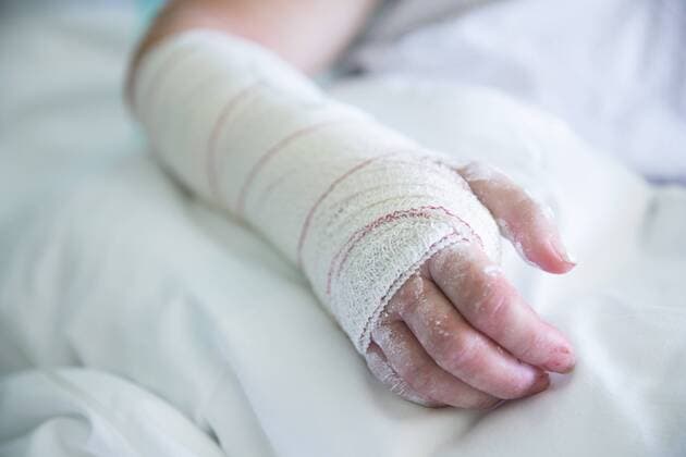 Woman in the hospital, operated hand model released Symbolfoto  ERLF000177