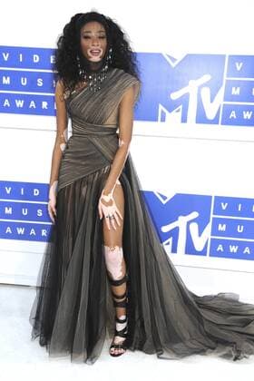 Winnie Harlow bei der Verleihung der MTV Video Music Awards 2016 im Madison Square Garden. New York, 28.08.2016 Foto:xD.xVanxTinex xFuturexImage