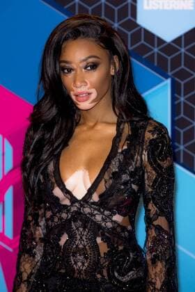 Winnie Harlow arrives at the MTV Europe Music Awards in Rotterdam, The Netherlands on November 6, 2016.  ROT20161106866 SVENxHOOGERHUIS