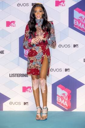 Winnie Harlow arrives at the MTV Europe Music Awards in Rotterdam, The Netherlands on November 6, 2016.  ROT20161106879 SVENxHOOGERHUIS