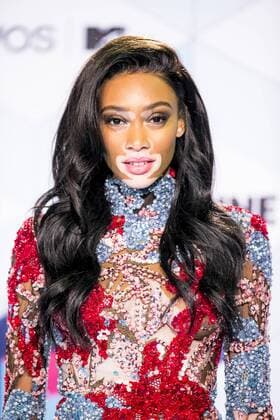 Winnie Harlow arrives at the MTV Europe Music Awards in Rotterdam, The Netherlands on November 6, 2016.  ROT20161106881 SVENxHOOGERHUIS
