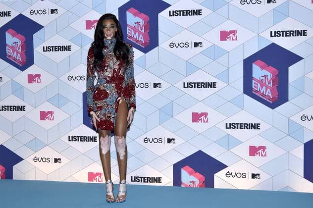 Winnie Harlow bei der Verleihung der MTV Europe Music Awards 2016 im Ahoy Rotterdam. Roterdam, 06.11.2016 Foto:xA.xHübnerx xFuturexImage