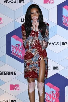 Winnie Harlow bei der Verleihung der MTV Europe Music Awards 2016 im Ahoy Rotterdam. Roterdam, 06.11.2016 Foto:xA.xHübnerx xFuturexImage