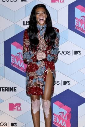 Winnie Harlow bei der Verleihung der MTV Europe Music Awards 2016 im Ahoy Rotterdam. Roterdam, 06.11.2016 Foto:xA.xHübnerx xFuturexImage