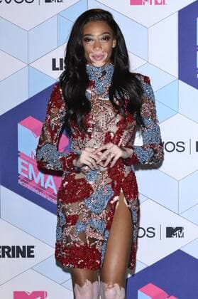 Winnie Harlow bei der Verleihung der MTV Europe Music Awards 2016 im Ahoy Rotterdam. Roterdam, 06.11.2016 Foto:xA.xHübnerx xFuturexImage