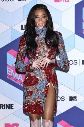 Winnie Harlow bei der Verleihung der MTV Europe Music Awards 2016 im Ahoy Rotterdam. Roterdam, 06.11.2016 Foto:xA.xHübnerx xFuturexImage