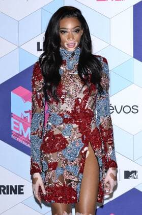 Winnie Harlow bei der Verleihung der MTV Europe Music Awards 2016 im Ahoy Rotterdam. Roterdam, 06.11.2016 Foto:xA.xHübnerx xFuturexImage