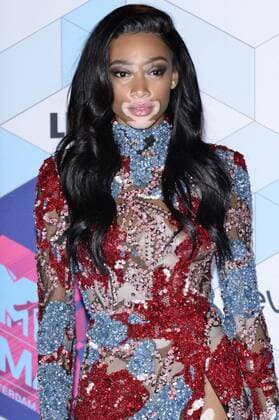Winnie Harlow bei der Verleihung der MTV Europe Music Awards 2016 im Ahoy Rotterdam. Roterdam, 06.11.2016 Foto:xA.xHübnerx xFuturexImage