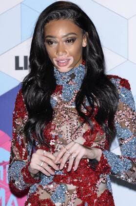 Winnie Harlow bei der Verleihung der MTV Europe Music Awards 2016 im Ahoy Rotterdam. Roterdam, 06.11.2016 Foto:xA.xHübnerx xFuturexImage