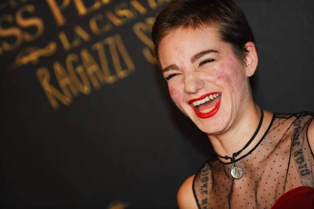 Die Insel der besonderen Kinder Filmpremiere in Rom Foto IPP CavalierexEmiliano Roma 05 12 2016 Roma. Red Carpet. Miss Peregrine. La casa dei ragazzi speciali -- Bebe Vio  0