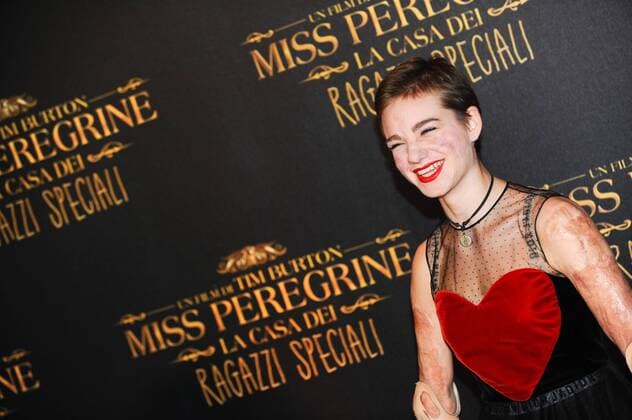 Die Insel der besonderen Kinder Filmpremiere in Rom Foto IPP CavalierexEmiliano Roma 05 12 2016 Roma. Red Carpet. Miss Peregrine. La casa dei ragazzi speciali -- Bebe Vio  0