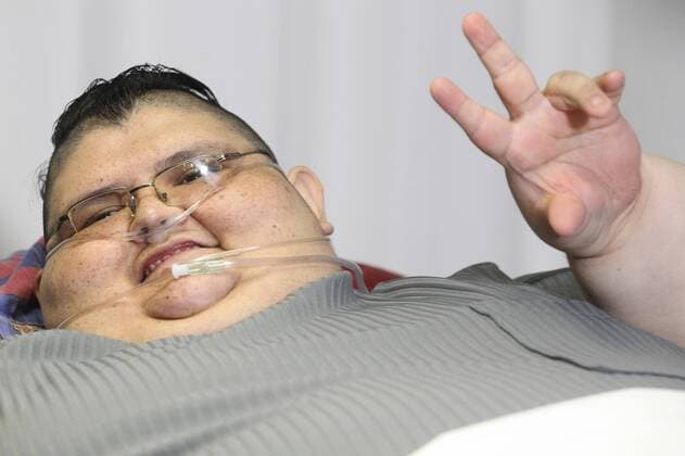 Mexican Juan Pedro Franco, the most obese man in the world with 590 kgs, delivers a press conference to announce the treatment he will undergo in order to loose a 10 per cent of his body-mass, in Guadalajara, Jalisco, Mexico, 21 December 2016. After thist first proceeding by surgeon Jose Castaneda at the Gastric Bypass Hospital in Guadalajara, Franco has two more surgeries scheduled. MOST OBESE MAN IN THE WORLD TAKES THE PATH OF HEALTH RECOVERY !ACHTUNG: NUR REDAKTIONELLE NUTZUNG!  GUA001 20161222-636179621502416037