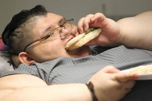 Mexican Juan Pedro Franco, the most obese man in the world with 590 kgs, delivers a press conference to announce the treatment he will undergo in order to loose a 10 per cent of his body-mass, in Guadalajara, Jalisco, Mexico, 21 December 2016. After thist first proceeding by surgeon Jose Castaneda at the Gastric Bypass Hospital in Guadalajara, Franco has two more surgeries scheduled. MOST OBESE MAN IN THE WORLD TAKES THE PATH OF HEALTH RECOVERY !ACHTUNG: NUR REDAKTIONELLE NUTZUNG!  GUA001 20161222-636179621532212037