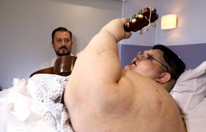 Themen der Woche Bilder des Tages Mexican Juan Pedro Franco, the most obese man in the world, plays guitar as he waits to be discharged in Guadalajara, Jalisco, Mexico, 17 May 2017. Franco had a stomach reduction surgery past 09 May. HOSPITAL DISCHARGES MOST OBESE MAN IN THE WORLD AFTER STOMACH REDUCTION SURGERY !ACHTUNG: NUR REDAKTIONELLE NUTZUNG!  Copyright: xUlisesxRuizxBasurtox GUA001 20170517-636306525019335642