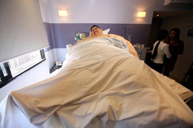 Mexican Juan Pedro Franco, the most obese man in the world, plays guitar as he waits to be discharged in Guadalajara, Jalisco, Mexico, 17 May 2017. Franco had a stomach reduction surgery past 09 May. HOSPITAL DISCHARGES MOST OBESE MAN IN THE WORLD AFTER STOMACH REDUCTION SURGERY !ACHTUNG: NUR REDAKTIONELLE NUTZUNG!  Copyright: xUlisesxRuizxBasurtox GUA001 20170517-636306525055214722