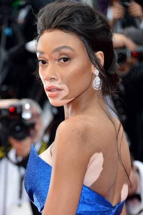 70th Cannes Film Festival 2017, Red carpet film Nelyubov . Pictured: Winnie Harlow  Copyright: xSimonexComix xCannesx xIPAx xCannesx