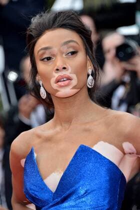 70th Cannes Film Festival 2017, Red carpet film Nelyubov . Pictured: Winnie Harlow  Copyright: xSimonexComix xCannesx xIPAx xCannesx