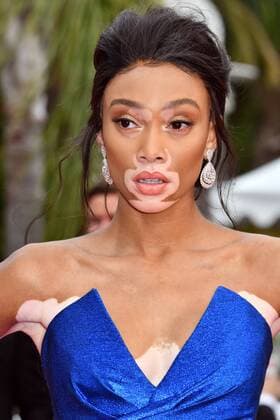 70Â°Cannes Film Festival 2017, Red carpet film Nelyubov . Pictured: Winnie Harlow  Copyright: xCamillaxMorandi Cannesx xIPAx xCannesx