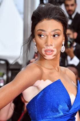 70Â°Cannes Film Festival 2017, Red carpet film Nelyubov . Pictured: Winnie Harlow  Copyright: xCamillaxMorandi Cannesx xIPAx xCannesx