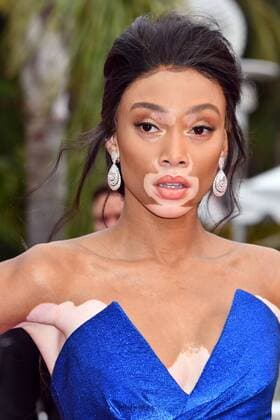 70Â°Cannes Film Festival 2017, Red carpet film Nelyubov . Pictured: Winnie Harlow  Copyright: xCamillaxMorandi Cannesx xIPAx xCannesx