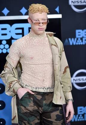 Model Shaun Ross attends the 17th annual BET Awards at Microsoft Theater in Los Angeles on June 25, 2017. The ceremony celebrates achievements in entertainment and honors music, sports, television, and movies released between April 1, 2016 and March 31, 2017.  LAP20170625070 CHRISTINExCHEW