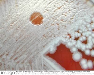 Bacillus anthracis gamma phage lysis on sheep blood agar. Bacillus anthracis gamma phage lysis on sheep blood agar, the culture is grown at 35 degrees centigrade without carbon dioxide. Image courtesy CDC Courtesy of Larry Stauffer, Oregon State Public Health Laboratory, 2002. 1023_04_66000final