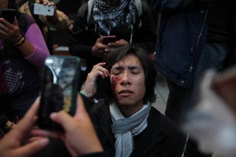 December 5, 2017 - Mexico City, Mexico - Portrait of a young activist injured during the protest against a law that militarizes crime fighting in the country outside the Senate, Mexico City, Mexico, December 5, 2017. Mexico City Mexico  - ZUMAn230 20171205_zaa_n230_552 Copyright: xEmilioxEspejelx