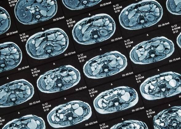 MRI examination detail MRI scan of the small intestine noninvasive medical test for the diagnosis of diseases of the intestine such as Crohns disease United Kingdom Europe Copyright: imageBROKER/SimonxBelcher ibxdig04739480.jpg