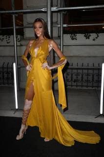 September 7, 2018 - New York, NY, USA - September 7, 2018 New York City..Winnie Harlow attending Harper s Bazaar ICONS party outside arrivals during New York Fashion Week on September 7, 2018 in New York City. New York USA  - ZUMAny1_ 20180907_zaf_ny1_279 Copyright: xKristinxCallahanx