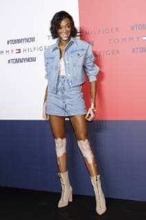 Canadian model Winnie Harlow poses for the cameras during Tokyo Icons event on October 8, 2018, Tokyo, Japan. The American fashion brand Tommy Hilfiger presented its Fall 2018 collection in Tokyo inviting international and Japanese celebrities such as F1 race driver Lewis Hamilton and model and Justin Bieber s wife Hailey Baldwin.  (gxta_THJIcons006)