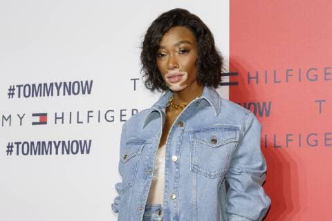Canadian model Winnie Harlow poses for the cameras during Tokyo Icons event on October 8, 2018, Tokyo, Japan. The American fashion brand Tommy Hilfiger presented its Fall 2018 collection in Tokyo inviting international and Japanese celebrities such as F1 race driver Lewis Hamilton and model and Justin Bieber s wife Hailey Baldwin.  (gxta_THJIcons032)