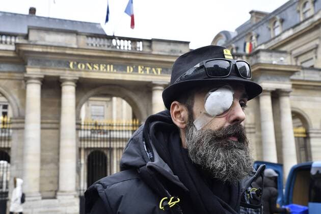 News Themen der Woche KW05 News Bilder des Tages Jerome Rodriguez the Yellow Vest wounded in Bastille during act XI yellow vests, in front of the Council of State or was filed an appeal for the ban of launchers type LBD (Flashball).  JulienxMattiax xLexPictorium LePictorium_0199438