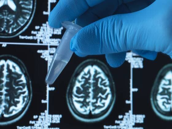 Pharmaceutical research into brain disorders including dementia and alzheimer s, eppendorf tube model released Symbolfoto property released  ABRF00366