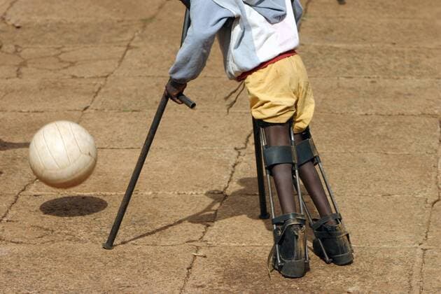Kenia - Nyabondo Rehabilitation Center 05.04.2006, Nyabondo, Kisumu, Kenia, KEN - Koerperbehinderte leben in der Missionsstation Nyabondo. Ein Junge mit Gehorthesen spielt auf dem Hof Fussball. Nyabondo Kisumu Kenia *** Kenya Nyabondo Rehabilitation Center 05 04 2006, Nyabondo, Kisumu, Kenya, KEN Disabled people live in the mission station Nyabondo A boy with orthoses plays on the farm Football Nyabondo Kisumu Kenya