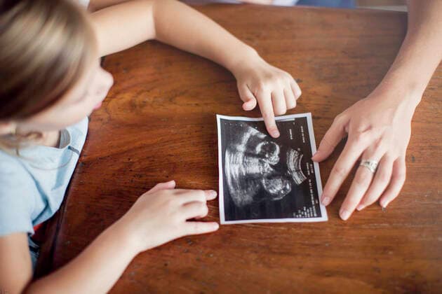 Girl looking at ultrasound photo of her new sibling to be  Copyright: SigridxOlsson B97291422