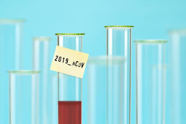 PHOTOMONAY, test tube with label and the inscription 2019 nCoV, symbol photo Coronavirus ** NUR FUER REDAKTIONELLE ZWECKE ** EDITORIAL USE ONLY **
