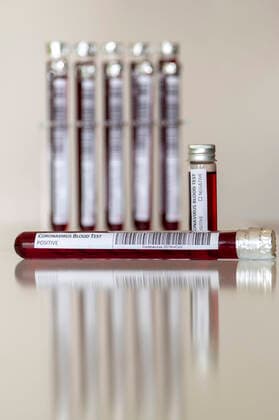 Blood sample in a test tube for coronavirus analysis and for the production of a vaccine Dummy Foto:xD.xAnoraganingrumx xFuturexImage
