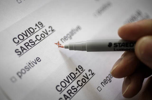 Coronavirus diagnosis COVID 19, SARS CoV 2, Symbol photo Berlin, 26 02 2020 Berlin Germany Copyright: xThomasxImo photothek.netx