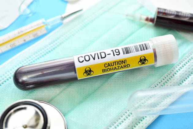 Blood collection tubes with the inscription Covid 19, symbol photo Coronavirus ** NUR FUER REDAKTIONELLE ZWECKE ** EDITORIAL USE ONLY **
